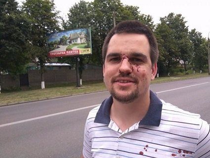 У Луцьку серед білого дня побили учасника АТО