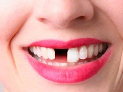 Виривав зуби жінкам під час сексу