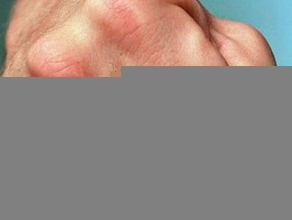 Побили серед білого дня