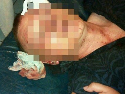 Азербайджанець жорстоко побив українського військового