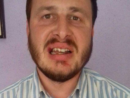 На Рівненщині священик УПЦ МП побив протоієрея Олександра