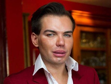 «Живий Кен» вдесяте змінив форму носа