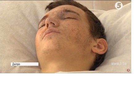 18-річний боєць-сирота підірвався на міні