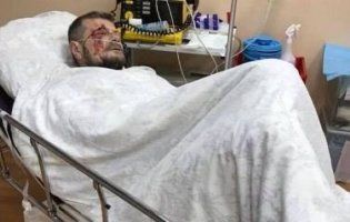 Замах на Мосійчука: все, що відомо (відео)
