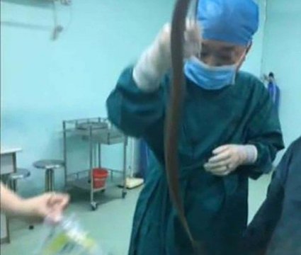 Вугор в "цікавому" місці -  знахідка китайських лікарів