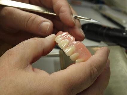 Чому зубні протези шкідливі?