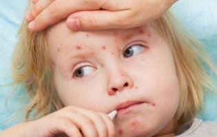 Кір нарешті відступає, але ризики ще залишаються