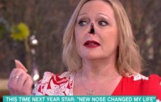 Жінка зняла носа в «прямому» ефірі (відео)