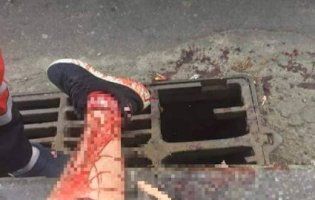 У Києві хлопець розірвав вену, провалившись ногою у водостік