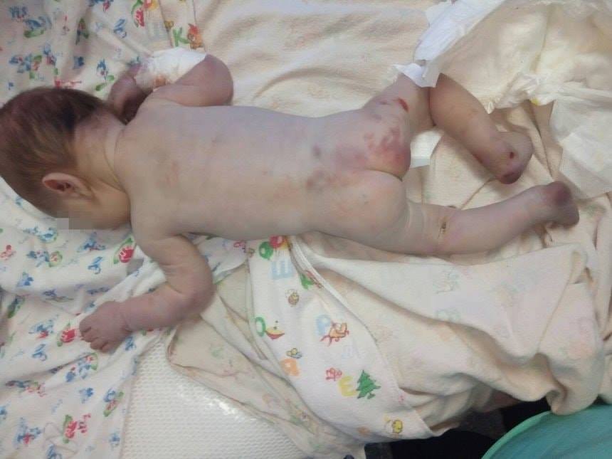 На Миколаївщині новонародженого малюка підкинули у лікарню