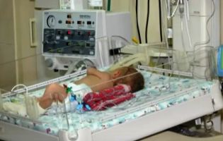 У Львові нема як виходжувати немовлят через нестачу деталей до апаратів штучного дихання (відео)