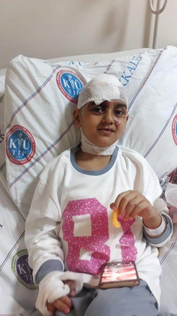 пес напав на дитину