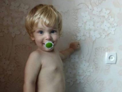 В Запорізькій області на дитину впала каструля з окропом