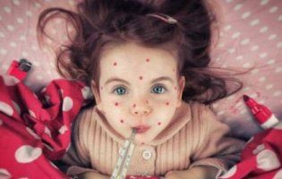 Львівські школи закривають на карантин через кір