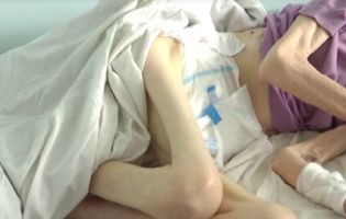 Важила 30 кілограмів: на Вінниччині рідний син морив голодом престарілу матір (відео)