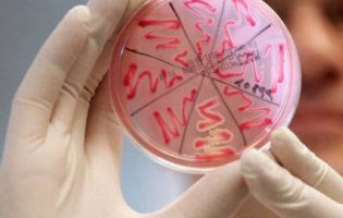 У волинянина виявили рідкісну інфекційну хворобу