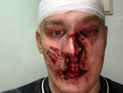 Представники «Нацкорпусу» звірськи побили екс-командира роти поліції «Східний корпус» Олега Ширяєва