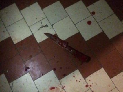 Вдаривши ножом студента, учень коледжу перерізав собі вени (фото 18+)