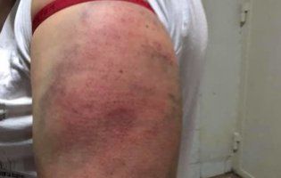 У столиці поліцейські жорстоко побили жінок (ФОТО)