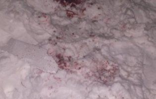 Кров на снігу: лікарі рятують харків’янина, якому феєрверком відірвало кисть і пошматувало лице
