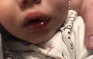 В Одесі няню звинувачують у побитті однорічного малюка