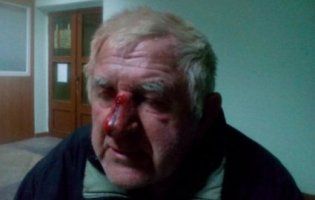 У Луцьку невідомі б'ють літніх людей