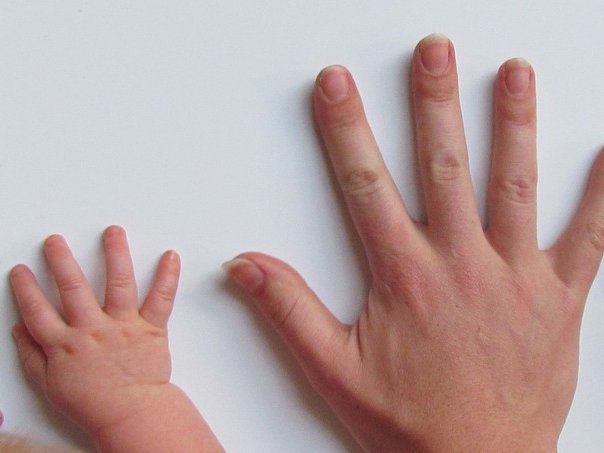 Як визначити хвороби за станом нігтів