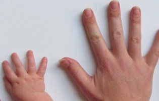 Як визначити хвороби за станом нігтів