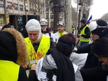 Результат протесту «жовтих жилетів» у Парижі: розбиті голови та відірвані руки (відео)
