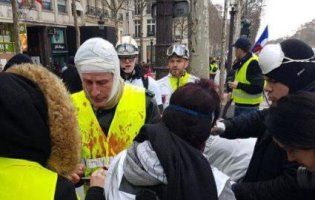 Результат протесту «жовтих жилетів» у Парижі: розбиті голови та відірвані руки (відео)