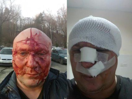 У Києві «зоотерористи» після суду проломили череп догхантеру (фото)