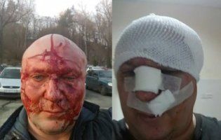 У Києві «зоотерористи» після суду проломили череп догхантеру (фото)