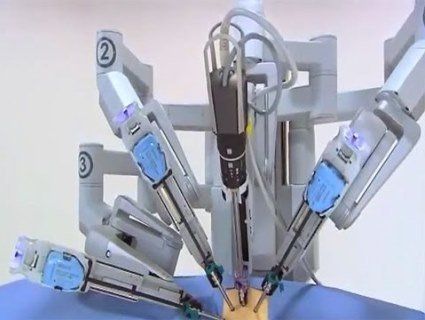 У Вінниці свою першу операцію провів робот-хірург (відео)
