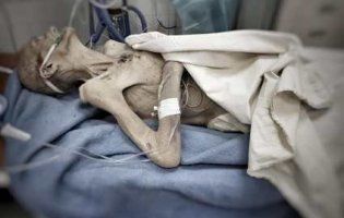 Фото, які жахнули Україну: син довів матір до стану «живої мумії»