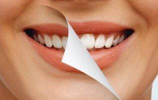 Відбілювання зубів: кому це заборонено