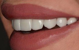 Топ продуктів, які зміцнюють зуби