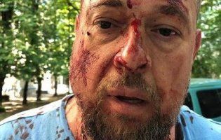 В Харкові активіста побили кастетами по голові (фото, відео)