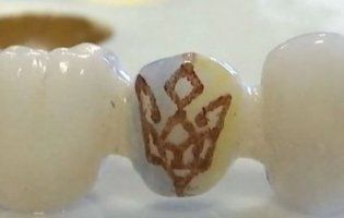 Мистецтво у роті: львів’янин створює картини на зубних коронках (відео)