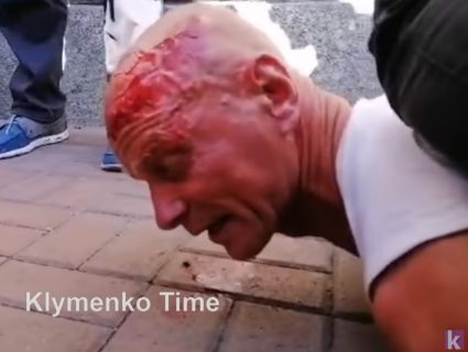 Крики «Ганьба!» під час промови Зеленського: «копи» розбили обличчя ветерану (відео)