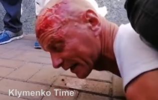 Крики «Ганьба!» під час промови Зеленського: «копи» розбили обличчя ветерану (відео)