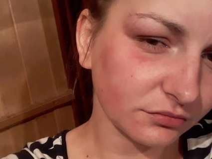 У Львові побили жінку за те, що не пригостила чоловіків…сигаретою