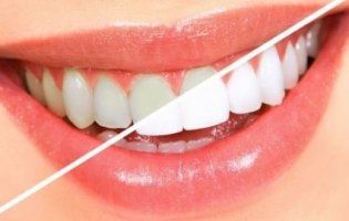 Неочікувано: чим загрожує безневинна процедура у стоматолога