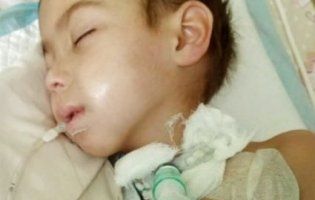 Від усклaднення після кору помер п’ятирічний хлопчик