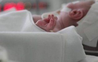 Пухлина, важча за малюка: у Львові хірурги рятували новонародженого волинянина