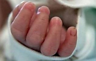 У Чернівцях померли сіамські близнюки: мати не відвідувала дітей