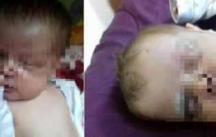 Пневмонія і перелом черепа: у Рівному немовля мало не «дійшло», поки мати ходила на пиво (відео)