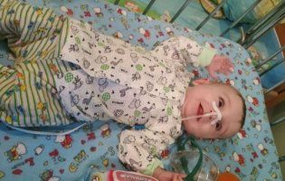 На Волині 7-місячний малюк після трьох операцій підхопив рідкісну хворобу