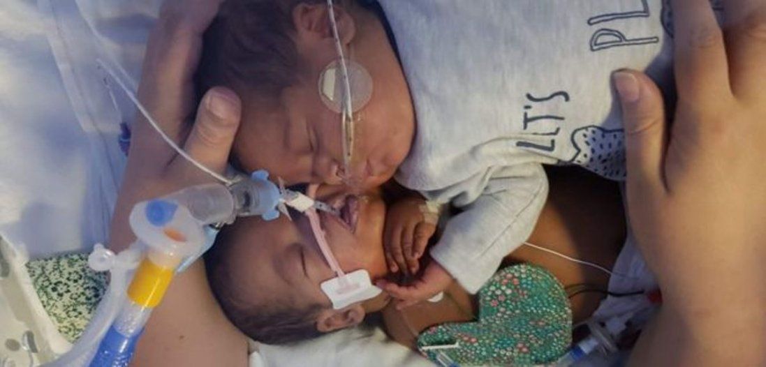 Немовля врятували обійми брата-близнюка (фото)