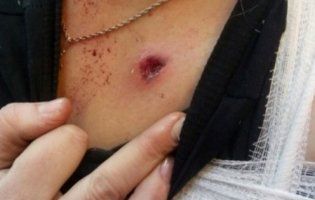 На Донбасі окупанти поранили жінку, яка гуляли з трирічною дитиною