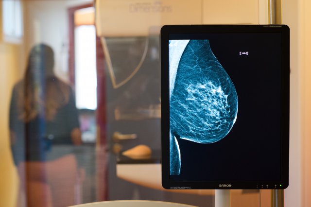 УЗД та мамограма - важливі етапи планових досліджень 